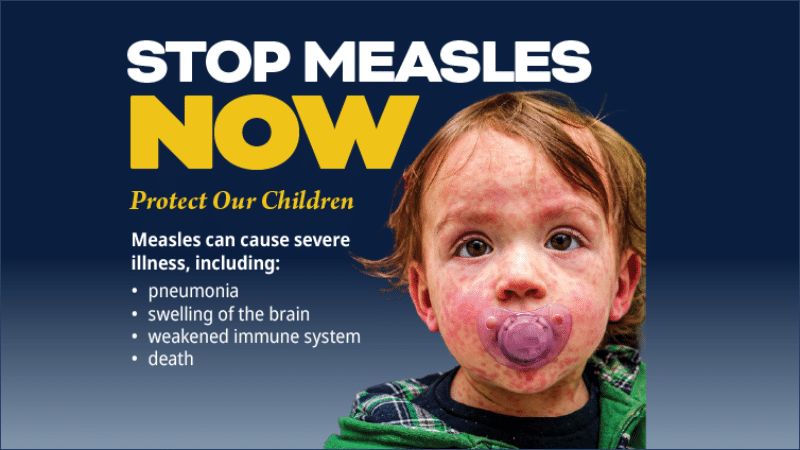 South Carolina Department of Public Health "Stop Measles Now" poster showing a young child with a measles rash on the face and arms